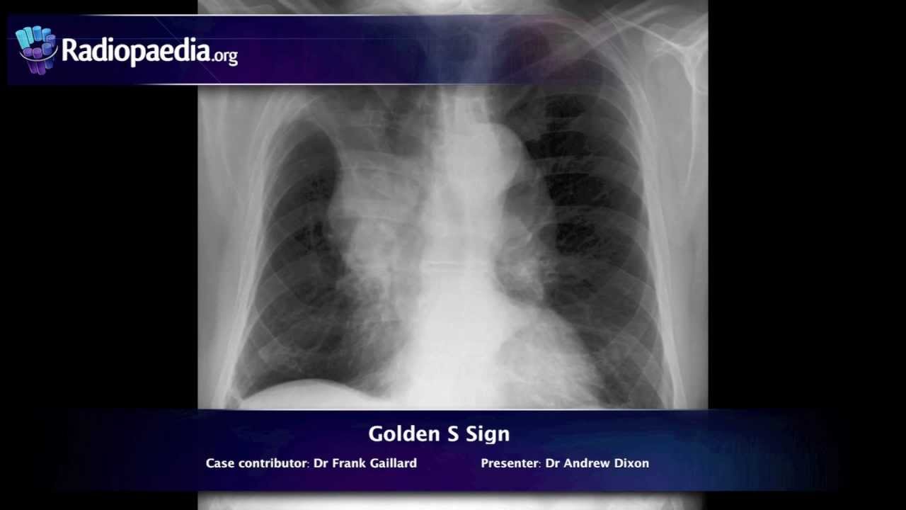 Buy Chest X-ray Interpretation and Beginners Anatomy Online in India - Etsy