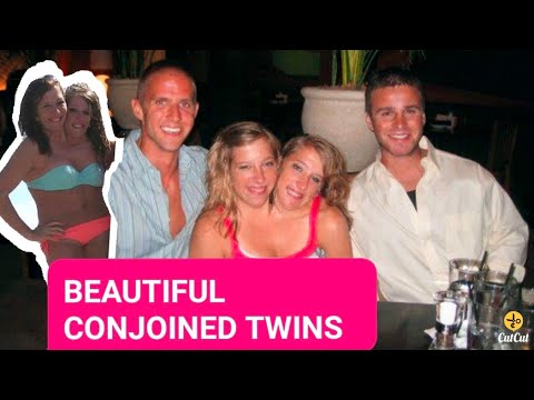 MAGKADIKIT NA KAMBAL Abby and Brittany HENSEL CONJOINED TWINS - YouTube