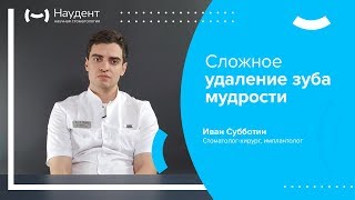 Сложное удаление зуба мудрости