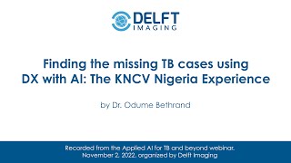 Finding the missing TB cases using DX with AI: The KNCV Nigeria Experience - by Dr. Odume Bethrand