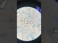 tinea versicolor or panau under microscope #medical #medicaleducation