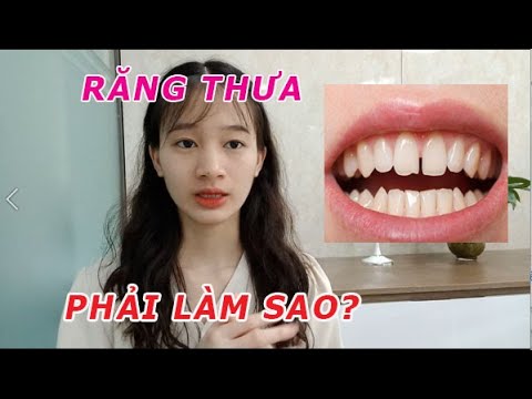 Video: 3 cách để chăm sóc răng thưa của bạn