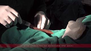 Coronary angiogram | a live demonstration