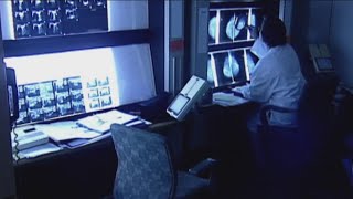 New breast cancer screening guidelines