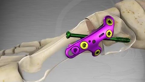 Lapidus Animation for Website