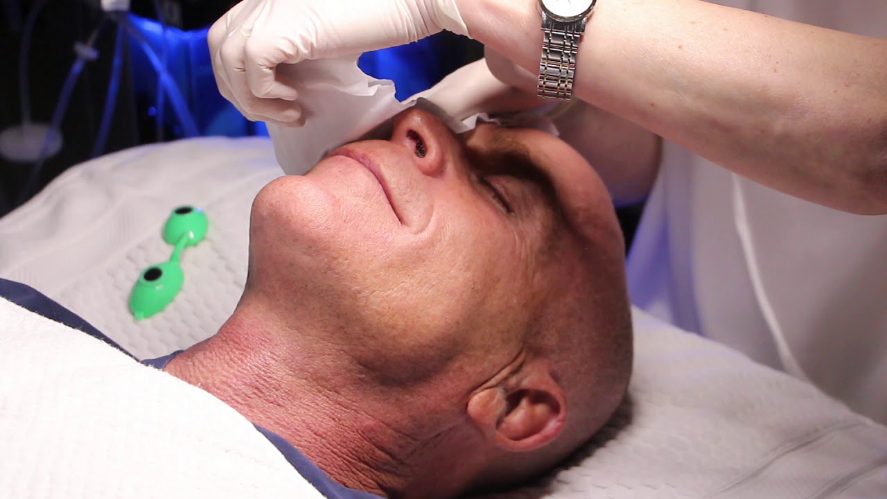 Banner for Hydrafacial Rejuvenation Treatment on Dr. Goldman