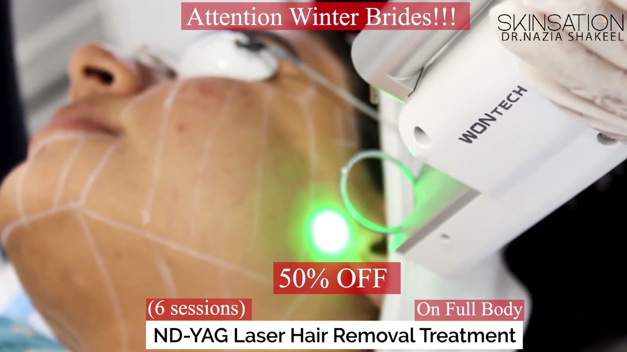 ND-Yag hair removal laser