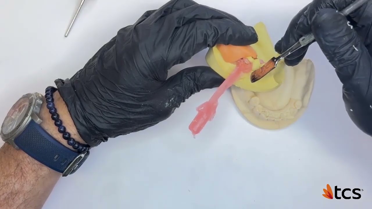 How to Repair a Clasp on a TCS Flexible Partial