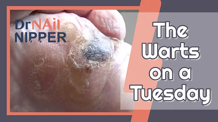 Emily and Warts are back on a Tuesday (2020)