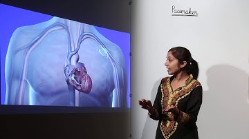 Pacemaker animation l ICSE l SECTION C l CLASS 12 BIOLOGY l BIOMEDICAL ENGINEERING l L193