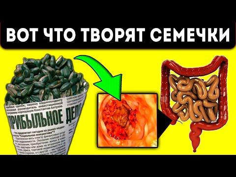 Раз и навсегда запомни! Вот что Семечки сделают с тобой, если их есть такими