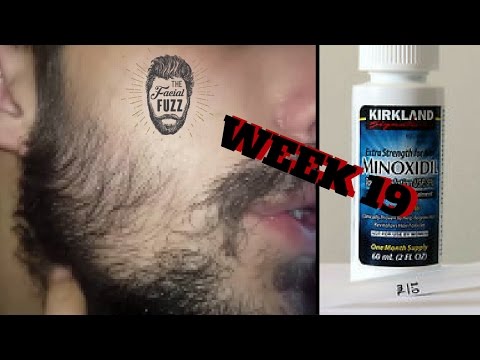 Minoxidil Beard | Week 19 | The Experiment | #FacialFuzzFridays