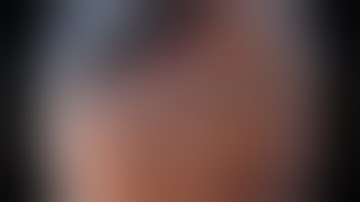 Marking after indigocarmine chromoendoscopy for gastric cancer of the angle