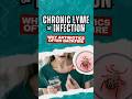 Why Antibiotics Often FAIL Chronic Lyme Disease (And Can Make It Worse)