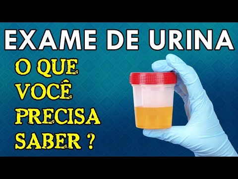 Vídeo: Por que o exame de urina é uma parte importante do diagnóstico médico?