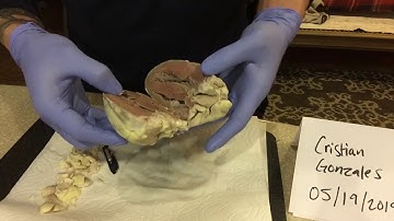 Week 2 | Video Lab Exercise - Cardiovascular System Heart