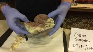 Week 2 | Video Lab Exercise - Cardiovascular System Heart