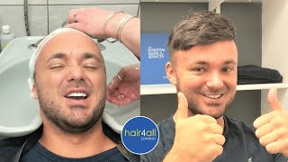 Before & After | Hair System | Non-Surgical Hair Replacement System Men/Women UK/USA | Shaun Nyland