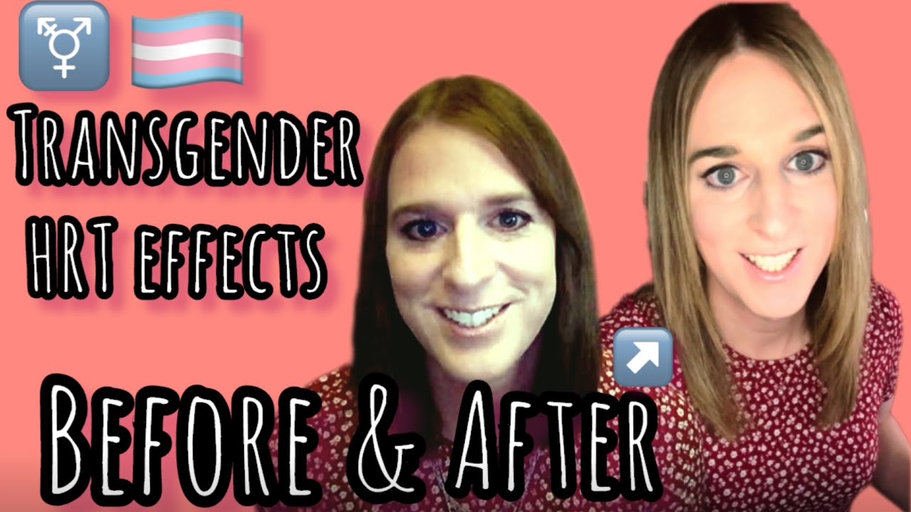 Trans HRT Effects MTF Before And After YouTube Trans HRT Effects MTF Before And After YouTube