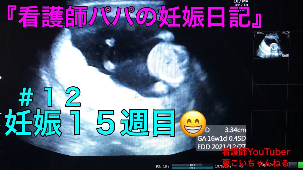 12妊娠１５週 看護師パパの妊娠日記 Youtube