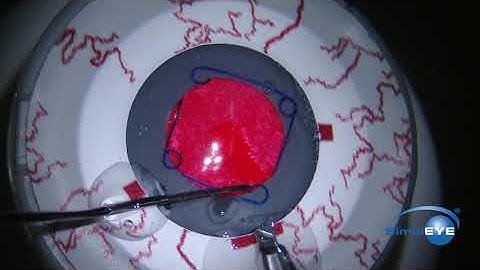 SimulEYE Small Pupil