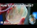 Bacterial Isolation on Petri Dish - Biology Lab Techniques