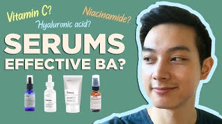 BEST SERUMS: NIACINAMIDE, VIT C, HYALURONIC ACID | Effective ba? My Personal Experience | Jan Angelo