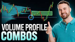 How I Make My Volume Profile Levels Stronger