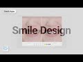 Workflow guide on how to design smile with medit smile design app