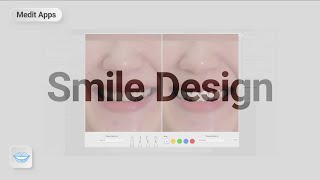 Workflow guide on how to design smile with Medit 'Smile Design' App