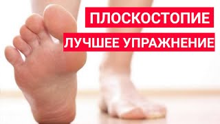 Плоскостопия упражнения