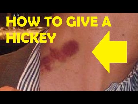 how to give a hickey leaving a mark easy