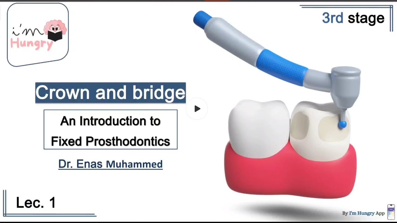 Crown and Bridge 3rd Stage - كراون مرحلة ثالثة - Lec1 introduction into fixed prosthodontic