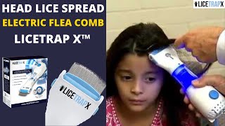 How do Head Lice Spread from Head to Head | Remove Head Lice using Electric Flea Comb | LICETRAP X™