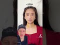Shocking TikTok Plastic Surgery Results | Plastic Surgeon Reacts
