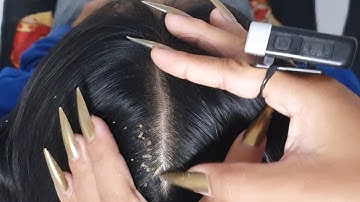 Beautiful Nails Scalp Scratching 💅 | ASMR Flake Removal & Hair Tingles 185