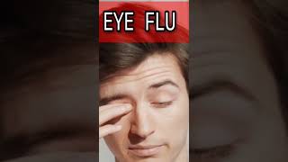 Eye Flu#youtubeshorts,#Conjunctivitis#Viral Shorts #Symptoms of Eye flu