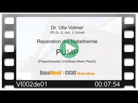 Video: Reparaturoperation Für Nabelhernien