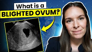 Understanding Blighted Ovum: Signs, Diagnosis, and Management