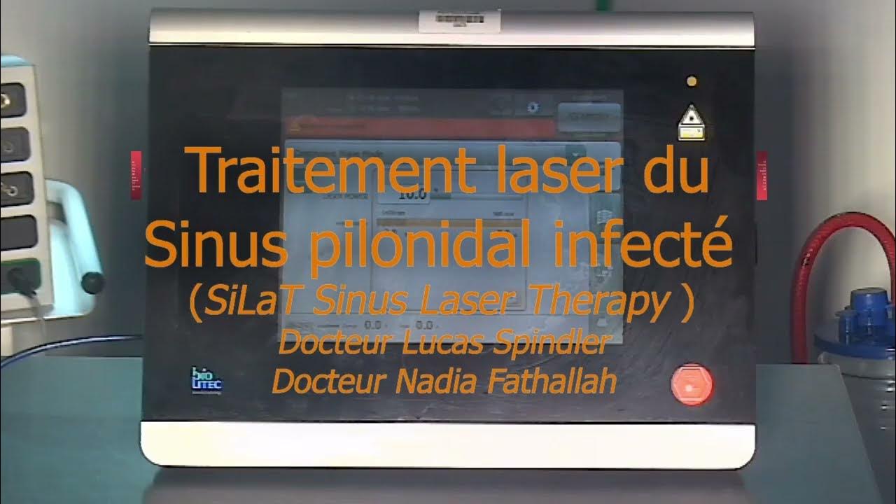 Chirurgie de kyste pilonidal au laser YouTube