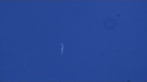 String Anomalies for Biologists p1.