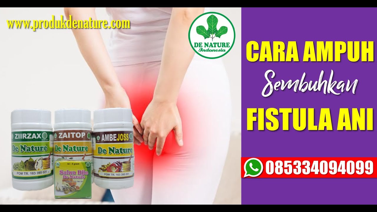CARA MENGOBATI FISTULA ANI BISUL BERNANAH - OBAT FISTULA ANI PALING