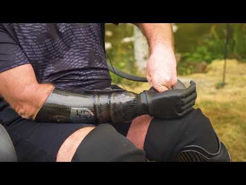 Mike Moore - i-limb ultra prosthetic hand testimonial