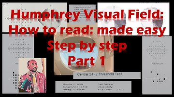 Humphrey Visual Field: how to read, made easy, Step by Step (Part 1)
