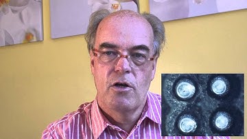 Open connections during Package on Package assembly