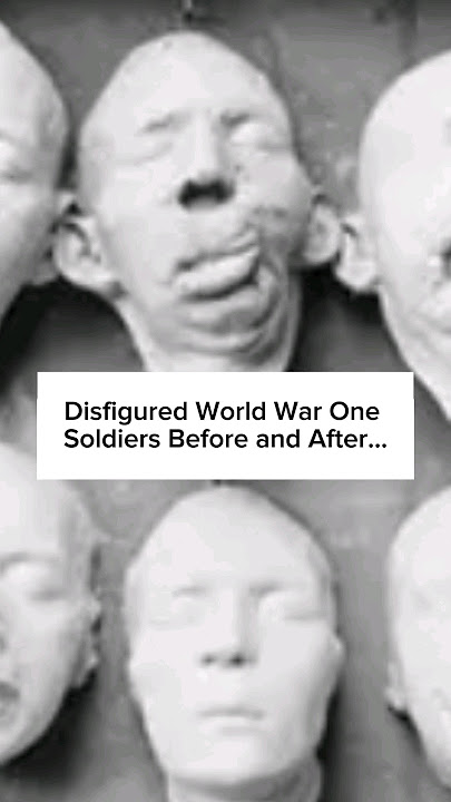 Disfigured World War One Soldiers Before and After Part 1 #ww1 #warshorts #beforeandafter