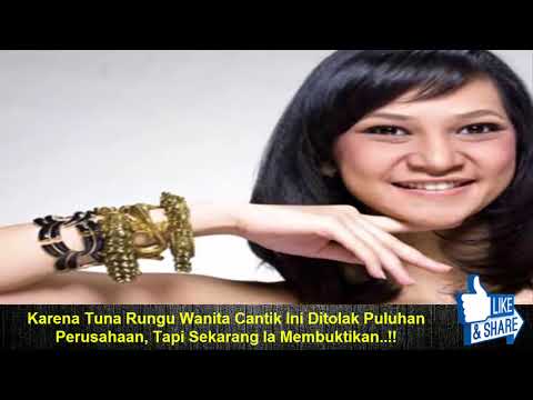 Karena Tuna Rungu Wanita Cantik Ini Ditolak Puluhan Perusahaan, Tapi Sekarang Ia Membuktikan..!!