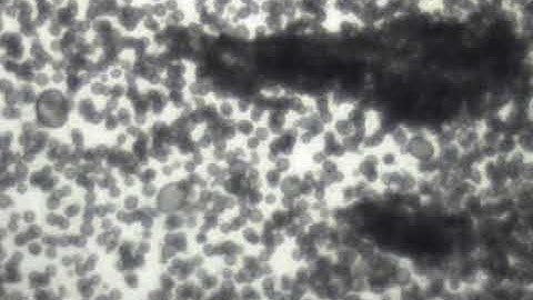 Pickering emulsion in electric field