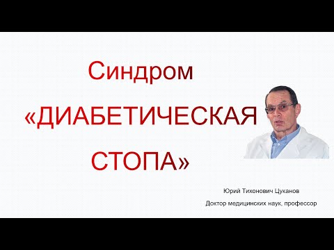 Синдром диабетической стопы: содержание, диагностика, лечение. Лекция для врачей.