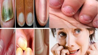âœ… QUE DIZEM AS UNHAS  A RESPEITO DA SUA SAÃšDE FÃSICA E MENTAL?